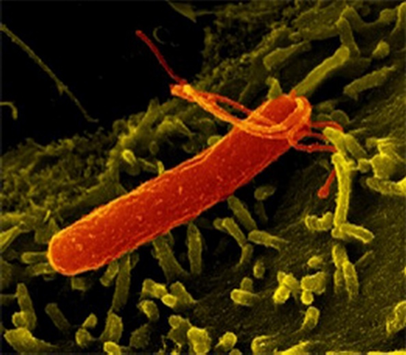 Helicobacter pylori 