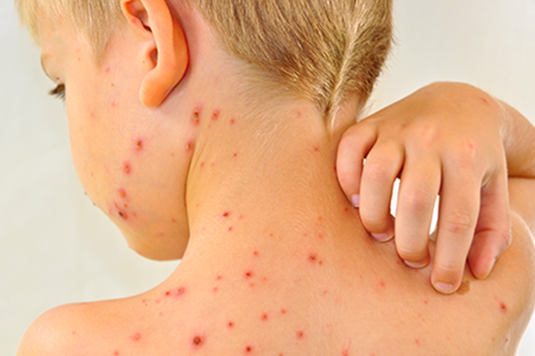 Sốt xuất huyết và những sai lầm cần tránh - Ảnh 4.