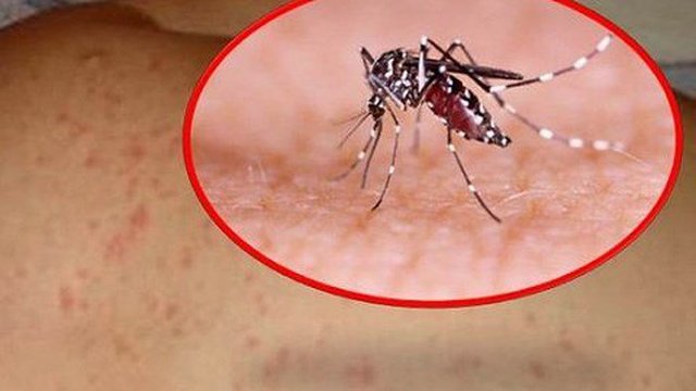 Sốt xuất huyết và những sai lầm cần tránh - Ảnh 3.