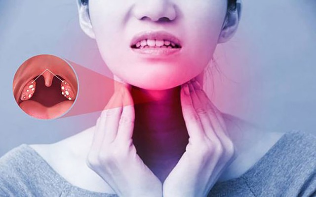 Viêm họng mạn tính là một bệnh thường gặp. Họng là nơi rất thuận lợi cho các yếu tố ngoại lai, virus và vi khuẩn xâm nhập vào cơ thể. Viêm họng mạn tính là một bệnh thường gặp. Họng là nơi rất thuận lợi cho các yếu tố ngoại lai, virus và vi khuẩn xâm nhập vào cơ thể.