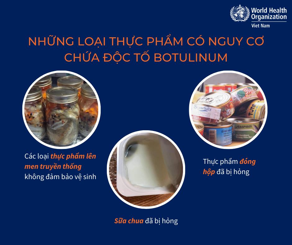 [Infographic] - Ngộ độc Botulinum từ thực phẩm và cách phòng tránh - Ảnh 2.